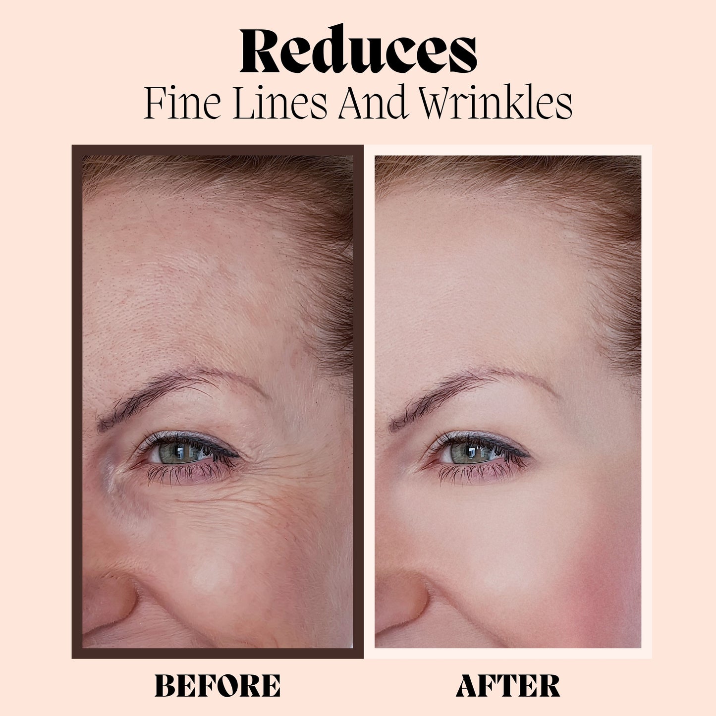 Hyaluronic Acid Serum